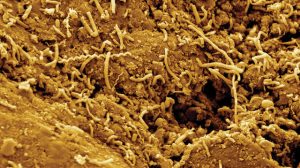 subseafloor microbes at 5000x magnification