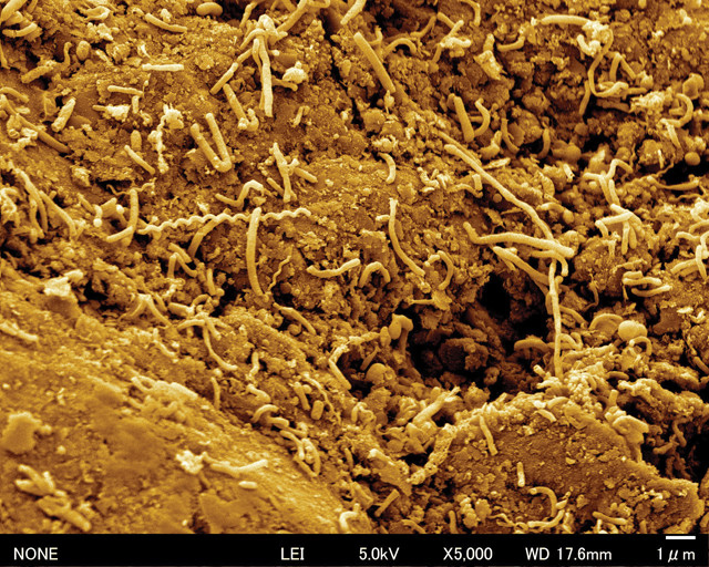 subseafloor microbes at 5000x magnification